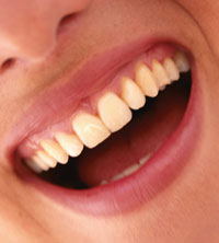 2008 Teeth