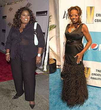 Before And After Gastric Bypass Surgery. After undergoing the surgery,