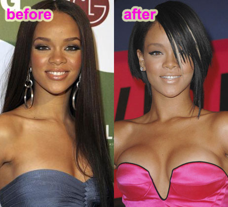 Did Rihanna get her breasts done or not
